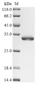 (Tris-Glycine gel) Discontinuous SDS-PAGE (reduced) with 5% enrichment gel and 15% separation gel. (Tris-Glycine gel) Discontinuous SDS-PAGE (reduced) with 5% enrichment gel and 15% separation gel.