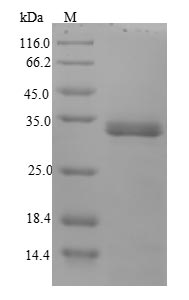 SDS-PAGE- Recombinant protein Yersinia ail