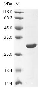 Recombinant Human cytomegalovirus Major capsid protein (MCP) , partial - image 1
