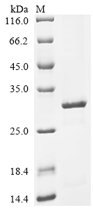 Recombinant Human cytomegalovirus Major capsid protein (MCP) , partial - image 1