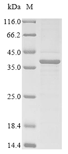 (Tris-Glycine gel) Discontinuous SDS-PAGE (reduced) with 5% enrichment gel and 15% separation gel. (Tris-Glycine gel) Discontinuous SDS-PAGE (reduced) with 5% enrichment gel and 15% separation gel.