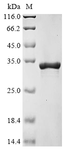 (Tris-Glycine gel) Discontinuous SDS-PAGE (reduced) with 5% enrichment gel and 15% separation gel. (Tris-Glycine gel) Discontinuous SDS-PAGE (reduced) with 5% enrichment gel and 15% separation gel.