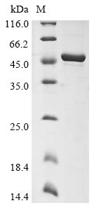 (Tris-Glycine gel) Discontinuous SDS-PAGE (reduced) with 5% enrichment gel and 15% separation gel. (Tris-Glycine gel) Discontinuous SDS-PAGE (reduced) with 5% enrichment gel and 15% separation gel.