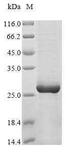 (Tris-Glycine gel) Discontinuous SDS-PAGE (reduced) with 5% enrichment gel and 15% separation gel. (Tris-Glycine gel) Discontinuous SDS-PAGE (reduced) with 5% enrichment gel and 15% separation gel.