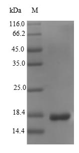SDS-PAGE- Recombinant protein Escherichia fanC