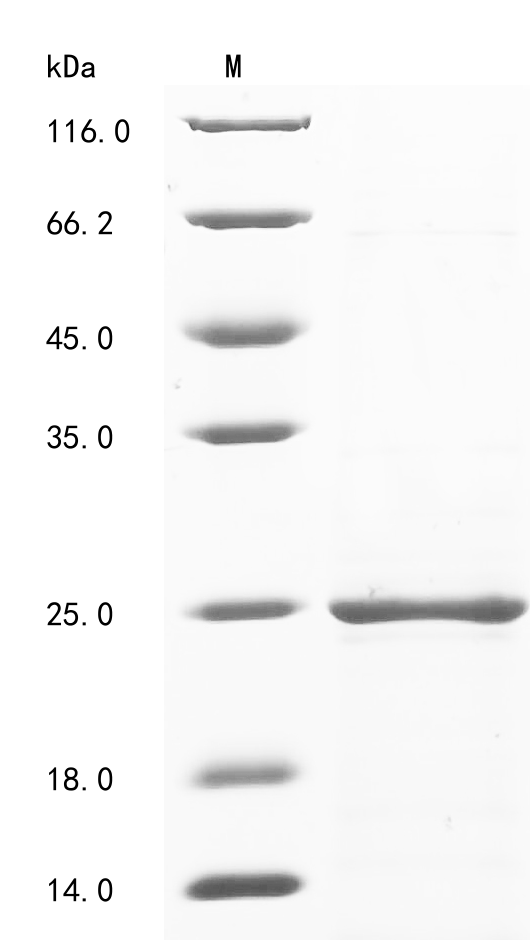 (Tris-Glycine gel) Discontinuous SDS-PAGE (reduced) with 5% enrichment gel and 15% separation gel. (Tris-Glycine gel) Discontinuous SDS-PAGE (reduced) with 5% enrichment gel and 15% separation gel.