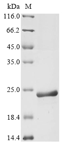 (Tris-Glycine gel) Discontinuous SDS-PAGE (reduced) with 5% enrichment gel and 15% separation gel. (Tris-Glycine gel) Discontinuous SDS-PAGE (reduced) with 5% enrichment gel and 15% separation gel.