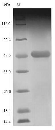 SDS-PAGE- Recombinant protein Zaire NP