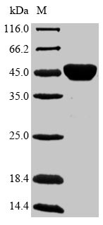SDS-PAGE- Recombinant protein Mycobacterium fbpB