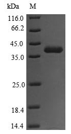 (Tris-Glycine gel) Discontinuous SDS-PAGE (reduced) with 5% enrichment gel and 15% separation gel. (Tris-Glycine gel) Discontinuous SDS-PAGE (reduced) with 5% enrichment gel and 15% separation gel.