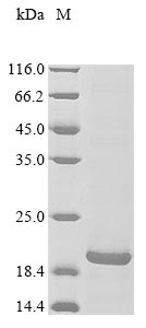 Recombinant Human Blood group Rh (CE) polypeptide (RHCE) , partial - image 1