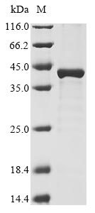 (Tris-Glycine gel) Discontinuous SDS-PAGE (reduced) with 5% enrichment gel and 15% separation gel. (Tris-Glycine gel) Discontinuous SDS-PAGE (reduced) with 5% enrichment gel and 15% separation gel.