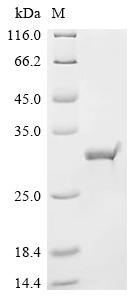 (Tris-Glycine gel) Discontinuous SDS-PAGE (reduced) with 5% enrichment gel and 15% separation gel. (Tris-Glycine gel) Discontinuous SDS-PAGE (reduced) with 5% enrichment gel and 15% separation gel.