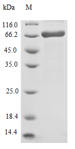 (Tris-Glycine gel) Discontinuous SDS-PAGE (reduced) with 5% enrichment gel and 15% separation gel. (Tris-Glycine gel) Discontinuous SDS-PAGE (reduced) with 5% enrichment gel and 15% separation gel.
