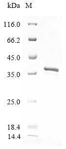 (Tris-Glycine gel) Discontinuous SDS-PAGE (reduced) with 5% enrichment gel and 15% separation gel. (Tris-Glycine gel) Discontinuous SDS-PAGE (reduced) with 5% enrichment gel and 15% separation gel.