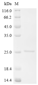 Recombinant Macaca fascicularis Hemoglobin subunit alpha-A/Q/R/T - image 1