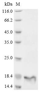(Tris-Glycine gel) Discontinuous SDS-PAGE (reduced) with 5% enrichment gel and 15% separation gel. (Tris-Glycine gel) Discontinuous SDS-PAGE (reduced) with 5% enrichment gel and 15% separation gel.