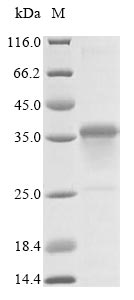 (Tris-Glycine gel) Discontinuous SDS-PAGE (reduced) with 5% enrichment gel and 15% separation gel. (Tris-Glycine gel) Discontinuous SDS-PAGE (reduced) with 5% enrichment gel and 15% separation gel.