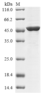 (Tris-Glycine gel) Discontinuous SDS-PAGE (reduced) with 5% enrichment gel and 15% separation gel. (Tris-Glycine gel) Discontinuous SDS-PAGE (reduced) with 5% enrichment gel and 15% separation gel.