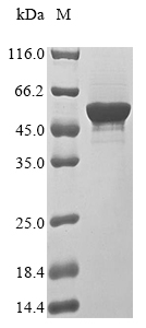 Recombinant Rabies virus Nucleoprotein (N) - image 1