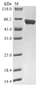 Recombinant Rabies virus Nucleoprotein (N) - image 1