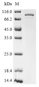 Recombinant Mouse Putative ATP-dependent RNA helicase Pl10 (D1Pas1) - image 1