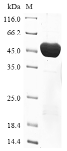 (Tris-Glycine gel) Discontinuous SDS-PAGE (reduced) with 5% enrichment gel and 15% separation gel. (Tris-Glycine gel) Discontinuous SDS-PAGE (reduced) with 5% enrichment gel and 15% separation gel.