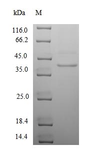 SDS-PAGE- Recombinant protein Human UL130