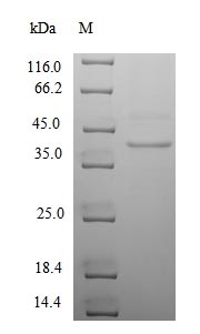 (Tris-Glycine gel) Discontinuous SDS-PAGE (reduced) with 5% enrichment gel and 15% separation gel. (Tris-Glycine gel) Discontinuous SDS-PAGE (reduced) with 5% enrichment gel and 15% separation gel.