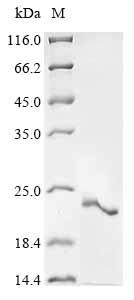(Tris-Glycine gel) Discontinuous SDS-PAGE (reduced) with 5% enrichment gel and 15% separation gel. (Tris-Glycine gel) Discontinuous SDS-PAGE (reduced) with 5% enrichment gel and 15% separation gel.
