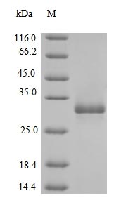 (Tris-Glycine gel) Discontinuous SDS-PAGE (reduced) with 5% enrichment gel and 15% separation gel. (Tris-Glycine gel) Discontinuous SDS-PAGE (reduced) with 5% enrichment gel and 15% separation gel.