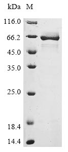 (Tris-Glycine gel) Discontinuous SDS-PAGE (reduced) with 5% enrichment gel and 15% separation gel. (Tris-Glycine gel) Discontinuous SDS-PAGE (reduced) with 5% enrichment gel and 15% separation gel.