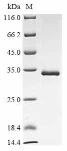 (Tris-Glycine gel) Discontinuous SDS-PAGE (reduced) with 5% enrichment gel and 15% separation gel. (Tris-Glycine gel) Discontinuous SDS-PAGE (reduced) with 5% enrichment gel and 15% separation gel.
