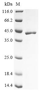 (Tris-Glycine gel) Discontinuous SDS-PAGE (reduced) with 5% enrichment gel and 15% separation gel. (Tris-Glycine gel) Discontinuous SDS-PAGE (reduced) with 5% enrichment gel and 15% separation gel.