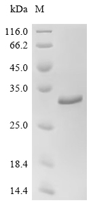 Recombinant Chlamydia pneumoniae Large cysteine-rich periplasmic protein OmcB (omcB) , partial - image 1