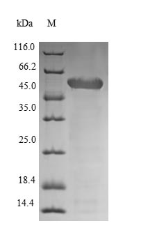 (Tris-Glycine gel) Discontinuous SDS-PAGE (reduced) with 5% enrichment gel and 15% separation gel. (Tris-Glycine gel) Discontinuous SDS-PAGE (reduced) with 5% enrichment gel and 15% separation gel.