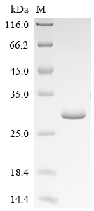 (Tris-Glycine gel) Discontinuous SDS-PAGE (reduced) with 5% enrichment gel and 15% separation gel. (Tris-Glycine gel) Discontinuous SDS-PAGE (reduced) with 5% enrichment gel and 15% separation gel.