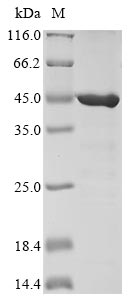 (Tris-Glycine gel) Discontinuous SDS-PAGE (reduced) with 5% enrichment gel and 15% separation gel.