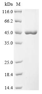 (Tris-Glycine gel) Discontinuous SDS-PAGE (reduced) with 5% enrichment gel and 15% separation gel. (Tris-Glycine gel) Discontinuous SDS-PAGE (reduced) with 5% enrichment gel and 15% separation gel.
