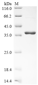 (Tris-Glycine gel) Discontinuous SDS-PAGE (reduced) with 5% enrichment gel and 15% separation gel.