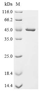 (Tris-Glycine gel) Discontinuous SDS-PAGE (reduced) with 5% enrichment gel and 15% separation gel.