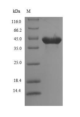 (Tris-Glycine gel) Discontinuous SDS-PAGE (reduced) with 5% enrichment gel and 15% separation gel. (Tris-Glycine gel) Discontinuous SDS-PAGE (reduced) with 5% enrichment gel and 15% separation gel.
