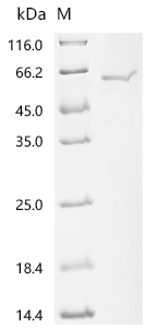 Recombinant Orientia tsutsugamushi 56 kDa type-specific antigen - image 1