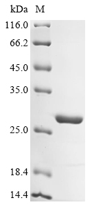 (Tris-Glycine gel) Discontinuous SDS-PAGE (reduced) with 5% enrichment gel and 15% separation gel. (Tris-Glycine gel) Discontinuous SDS-PAGE (reduced) with 5% enrichment gel and 15% separation gel.