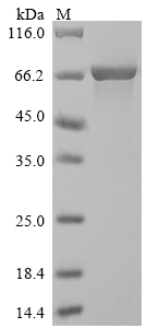 (Tris-Glycine gel) Discontinuous SDS-PAGE (reduced) with 5% enrichment gel and 15% separation gel. (Tris-Glycine gel) Discontinuous SDS-PAGE (reduced) with 5% enrichment gel and 15% separation gel.