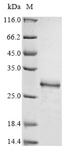 (Tris-Glycine gel) Discontinuous SDS-PAGE (reduced) with 5% enrichment gel and 15% separation gel. (Tris-Glycine gel) Discontinuous SDS-PAGE (reduced) with 5% enrichment gel and 15% separation gel.