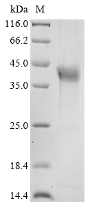 (Tris-Glycine gel) Discontinuous SDS-PAGE (reduced) with 5% enrichment gel and 15% separation gel.