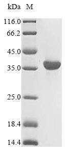 (Tris-Glycine gel) Discontinuous SDS-PAGE (reduced) with 5% enrichment gel and 15% separation gel. (Tris-Glycine gel) Discontinuous SDS-PAGE (reduced) with 5% enrichment gel and 15% separation gel.