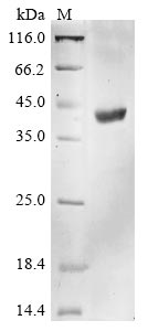 (Tris-Glycine gel) Discontinuous SDS-PAGE (reduced) with 5% enrichment gel and 15% separation gel. (Tris-Glycine gel) Discontinuous SDS-PAGE (reduced) with 5% enrichment gel and 15% separation gel.