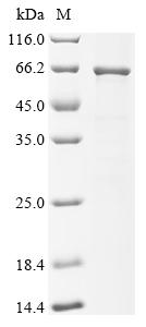 Recombinant Klebsiella pneumoniae Maltoporin (lamB) - image 1